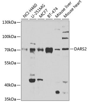 DARS2 Rabbit polyclonal antibody