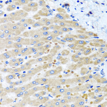 DARS2 Rabbit polyclonal antibody