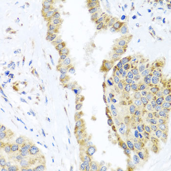 DARS2 Rabbit polyclonal antibody