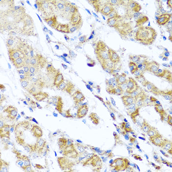 DARS2 Rabbit polyclonal antibody