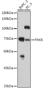 PAK6 Rabbit polyclonal antibody