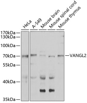 VANGL2 Rabbit polyclonal antibody