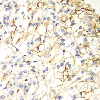 VANGL2 Rabbit polyclonal antibody