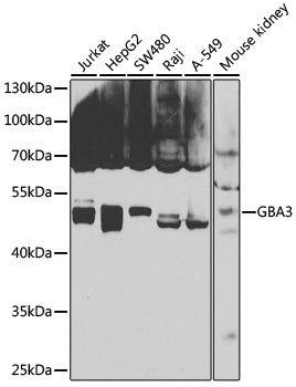GBA3 Rabbit polyclonal antibody