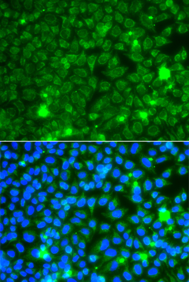 GBA3 Rabbit polyclonal antibody