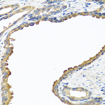 NYX Rabbit polyclonal antibody