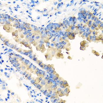 NYX Rabbit polyclonal antibody