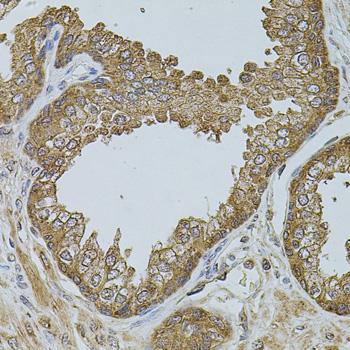 CHRFAM7A Rabbit polyclonal antibody