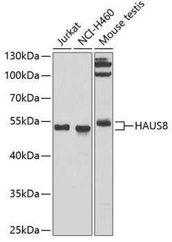 HAUS8 Rabbit polyclonal antibody