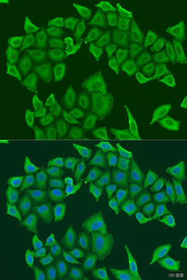 HAUS8 Rabbit polyclonal antibody