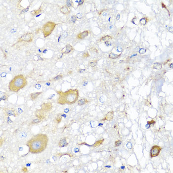CALHM1 Rabbit polyclonal antibody