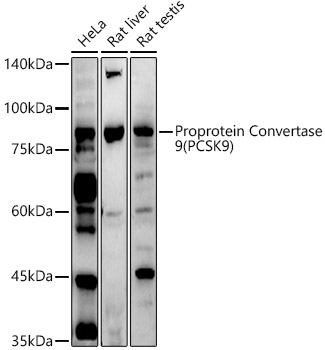 Proprotein Convertase 9(PCSK9) Rabbit polyclonal antibody