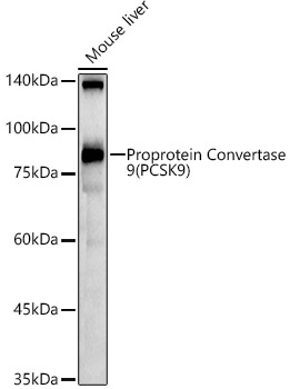 Proprotein Convertase 9(PCSK9) Rabbit polyclonal antibody
