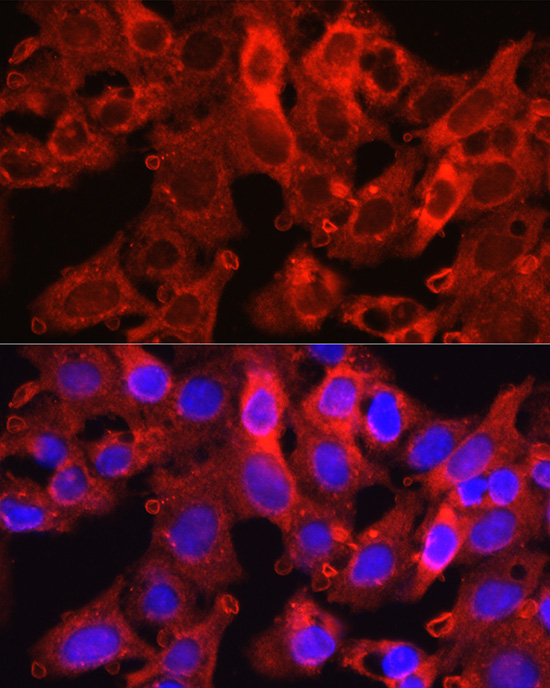 Proprotein Convertase 9(PCSK9) Rabbit polyclonal antibody