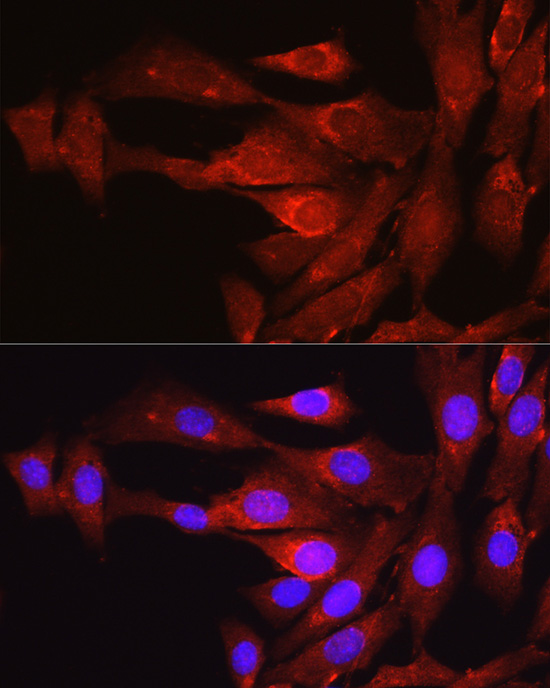 Proprotein Convertase 9(PCSK9) Rabbit polyclonal antibody