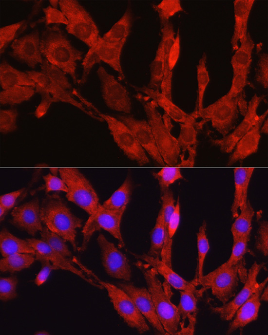 Proprotein Convertase 9(PCSK9) Rabbit polyclonal antibody