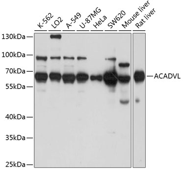 ACADVL Rabbit polyclonal antibody