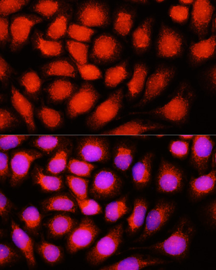 ACADVL Rabbit polyclonal antibody