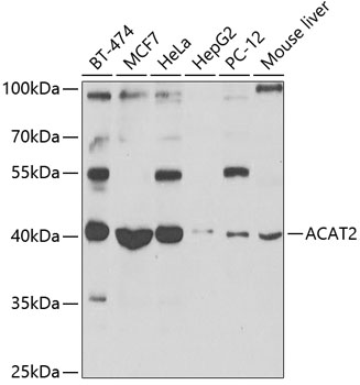 ACAT2 Rabbit polyclonal antibody