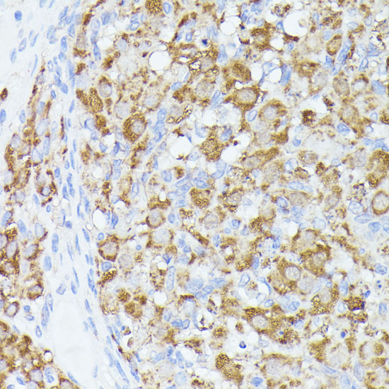 ACAT2 Rabbit polyclonal antibody