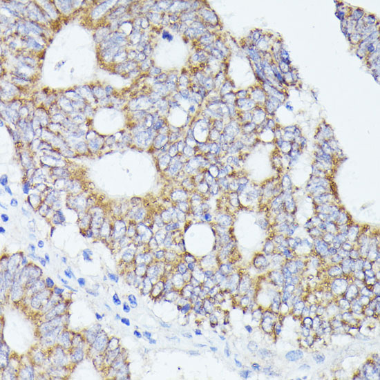 ACAT2 Rabbit polyclonal antibody