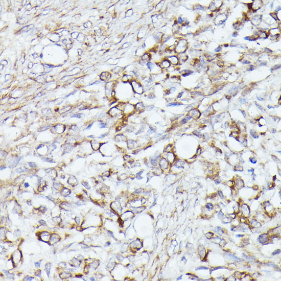 ACAT2 Rabbit polyclonal antibody