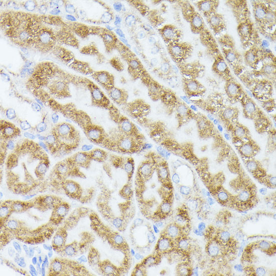 ACAT2 Rabbit polyclonal antibody