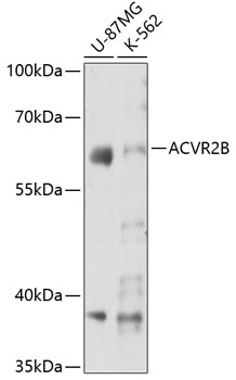 ACVR2B Rabbit polyclonal antibody
