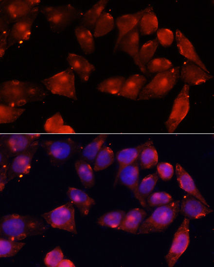 ACVR2B Rabbit polyclonal antibody