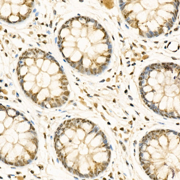 ADAR1 Rabbit polyclonal antibody