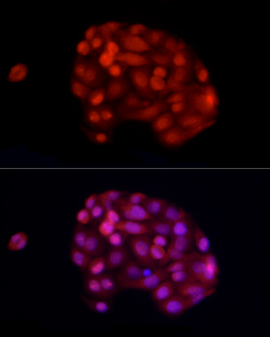 ADAR1 Rabbit polyclonal antibody