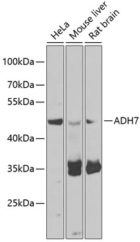 ADH7 Rabbit polyclonal antibody