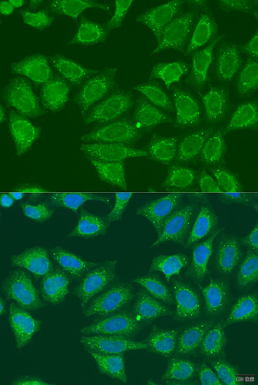ADH7 Rabbit polyclonal antibody