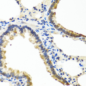 ANGPT1 Rabbit polyclonal antibody