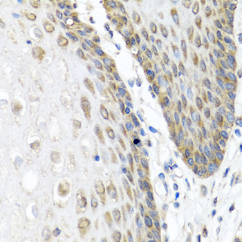ANGPT1 Rabbit polyclonal antibody