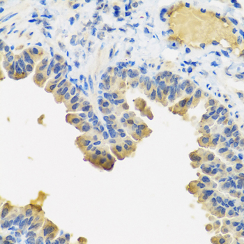 ANGPT1 Rabbit polyclonal antibody
