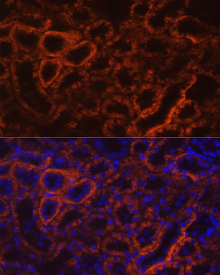 Cadherin 16 Rabbit polyclonal antibody