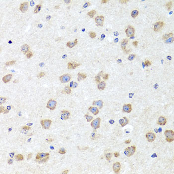 [KO Validated] CHD1 Rabbit polyclonal antibody