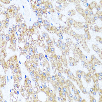 [KO Validated] CHD1 Rabbit polyclonal antibody