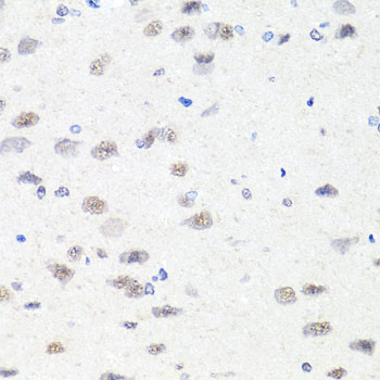 [KO Validated] CHD1 Rabbit polyclonal antibody
