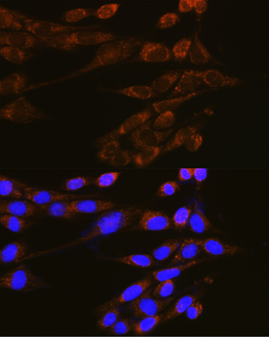 DNM2 Rabbit polyclonal antibody