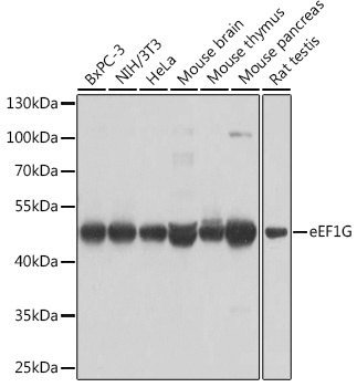 eEF1G Rabbit polyclonal antibody