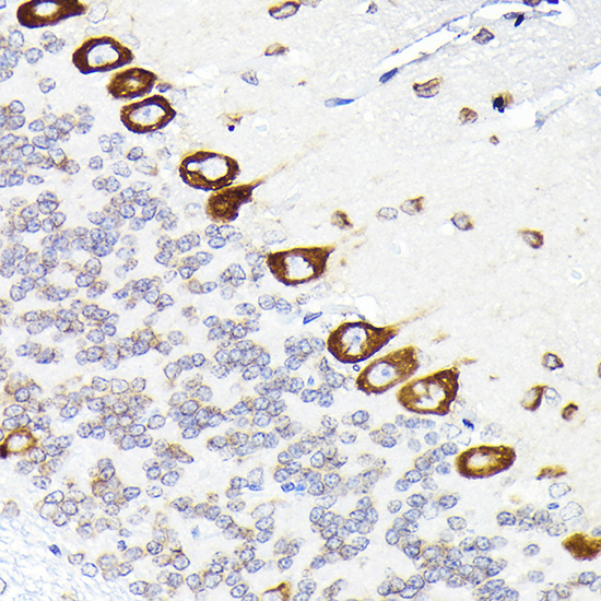 eEF1G Rabbit polyclonal antibody