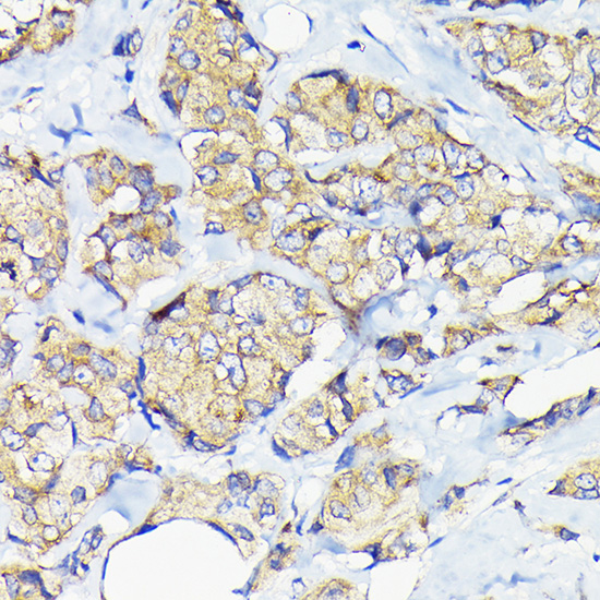 eEF1G Rabbit polyclonal antibody