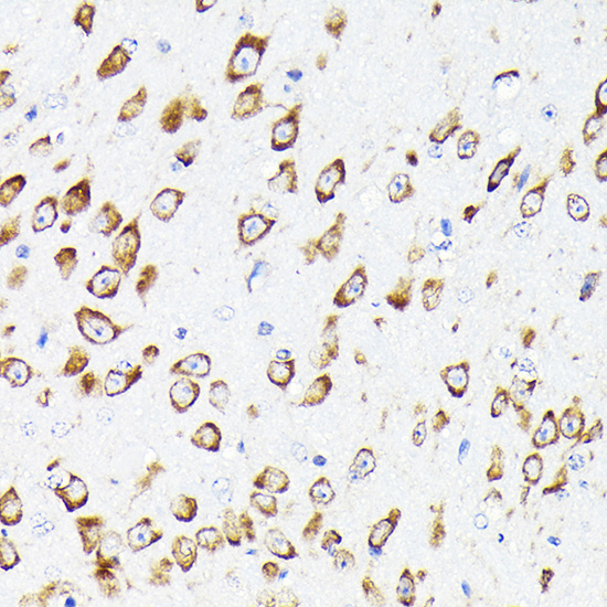 eEF1G Rabbit polyclonal antibody