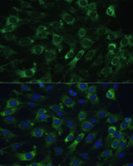 eEF1G Rabbit polyclonal antibody