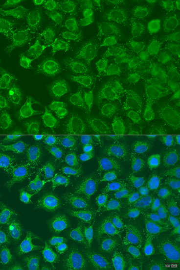 EIF2B1 Rabbit polyclonal antibody