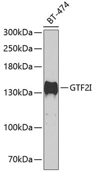 GTF2I Rabbit polyclonal antibody