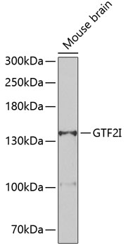 GTF2I Rabbit polyclonal antibody