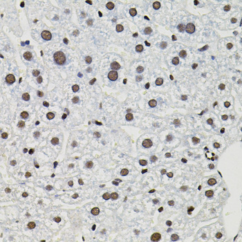 GTF2I Rabbit polyclonal antibody